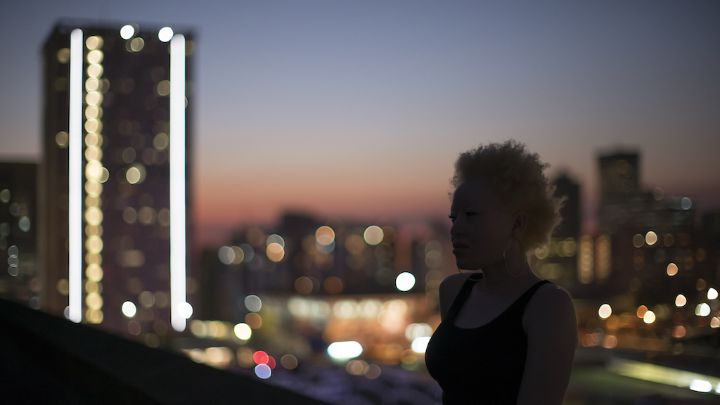 Regina being photographed for the Climb For Albinism project